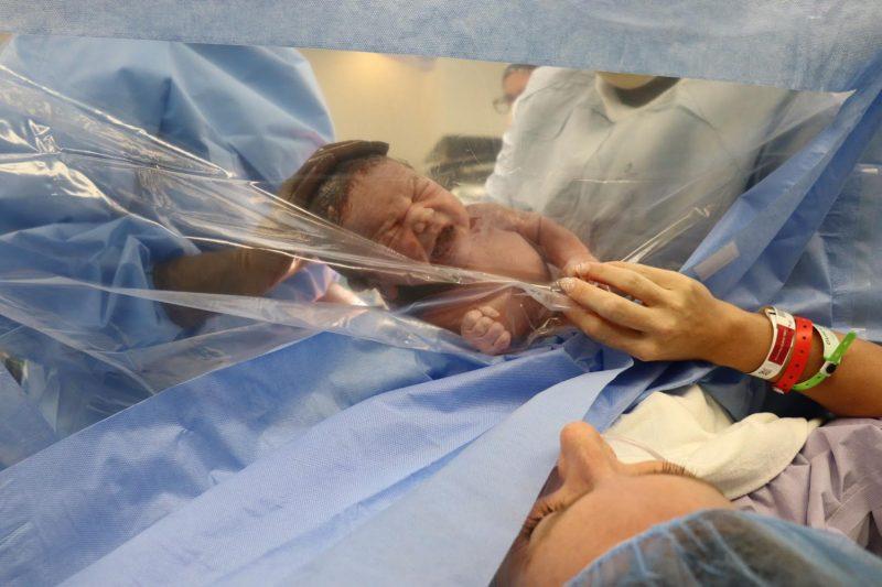 baby pushed against clear plastic after a c-section to show mama who reaches hand to clear plastic.